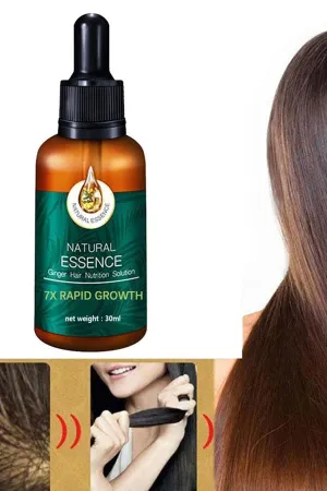 Natural Ginger 30 ml Zencefil İçerikli Saç Bakım Serumu – Besleyici Saç Bakımı